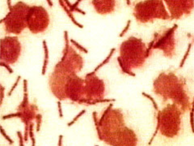 18oktmiltbrandKenya400.jpg (33083 bytes)